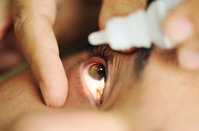 Woman using eye drops for glaucoma treatment