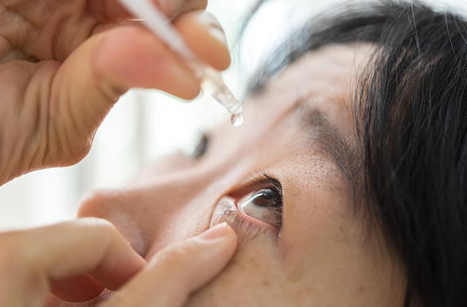 Người phụ nữ sử dụng thuốc nhỏ mắt để điều trị bệnh tăng nhãn áp