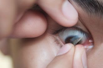 Das erste Mal Kontaktlinsen – Tipps und Tricks für Einsteiger – Dynoptic