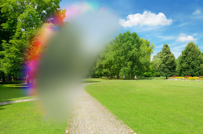 Visão de uma paisagem de um parque obstruída em parte por visão de alguém com enxaqueca ocular ou enxaqueca com aura.

