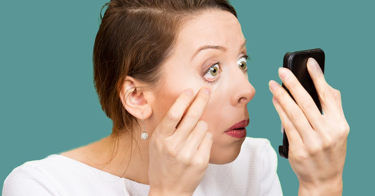 woman with swollen eyelids checking on her smartphone