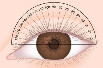 Prescription lunette vs verre de contact best sale