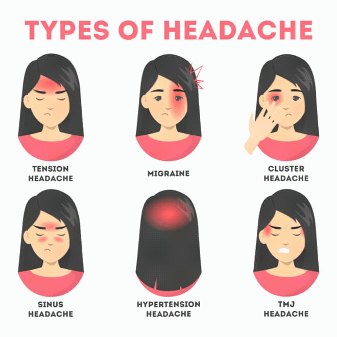 Sinus Headache Location Chart
