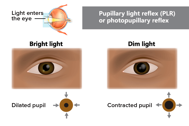 dilated pupils vs normal pupils