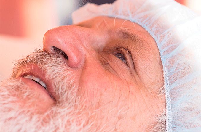 older man getting prepped for eyelid papilloma removal surgery