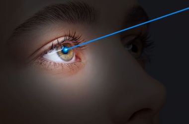 laser eye surgery