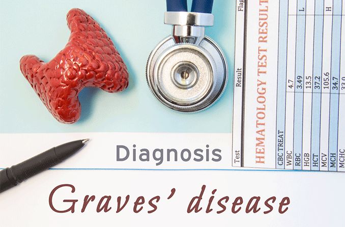 Grave's disease diagnosis