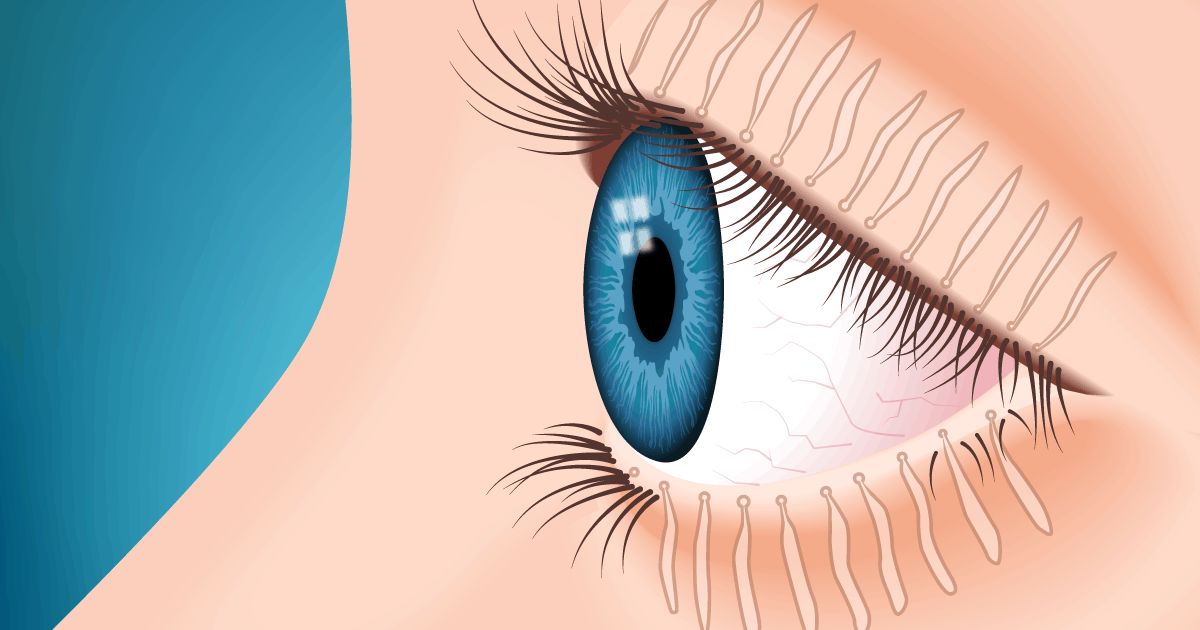 Illustrazione di occhio con ghiandole di Meibomio