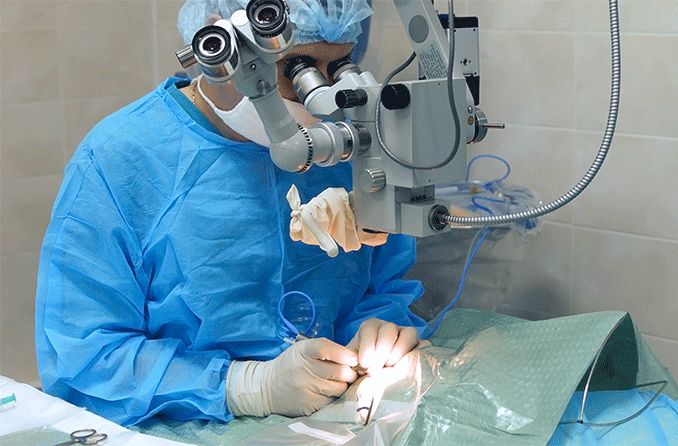 ophthalmologist performing phacoemulsification during cataract surgery