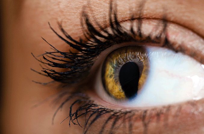 closeup image of an eye with cat-eye syndrome