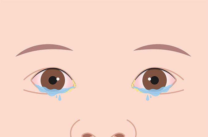 illustration of watery eyes