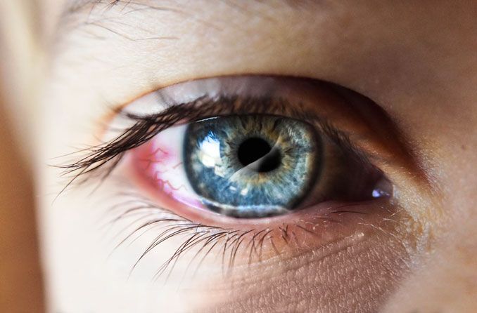 7 Most Common Eye Injuries and How to Treat Them