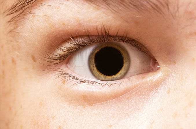 closeup of a dilated eye