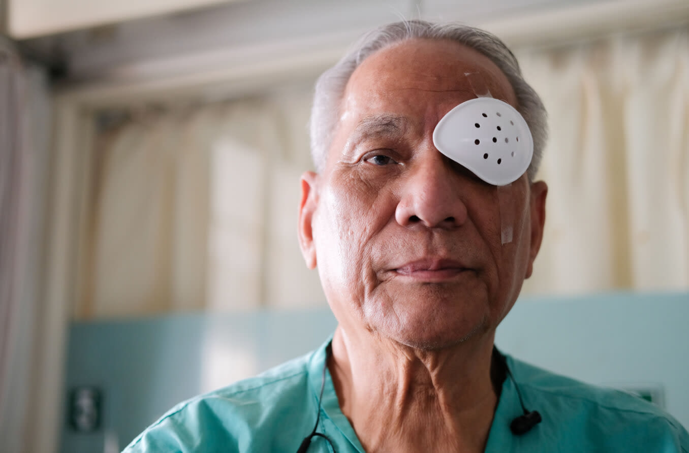 Mujer mayor usando un parche protector para el ojo como parte de los cuidados después de operación de cataratas.