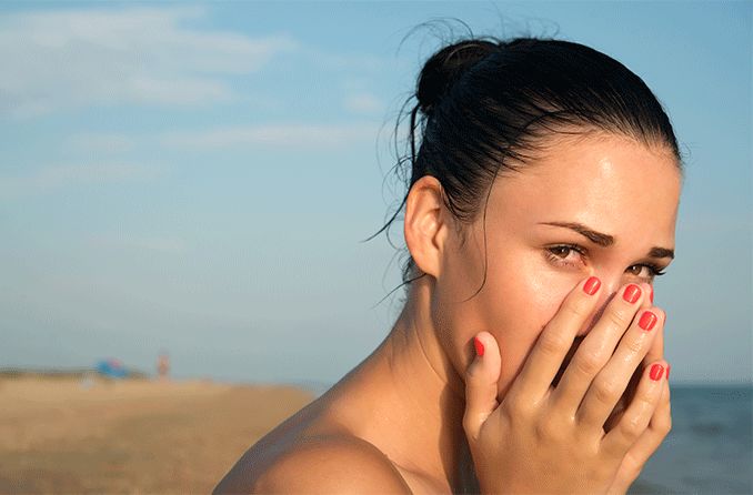 woman with ocular syphilis on the beach