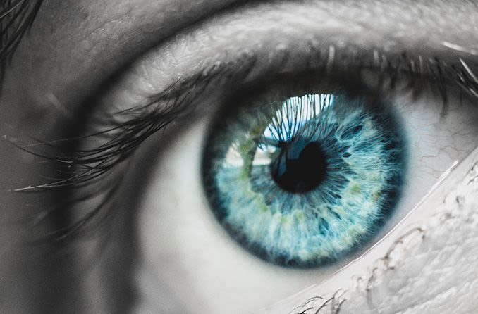 closeup of eye with rare eye disease