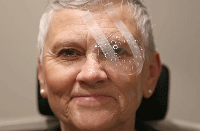 Mulher em recuperação de cirurgia de catarata