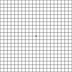 Amsler grid test | Macular degeneration test chart | All About Vision