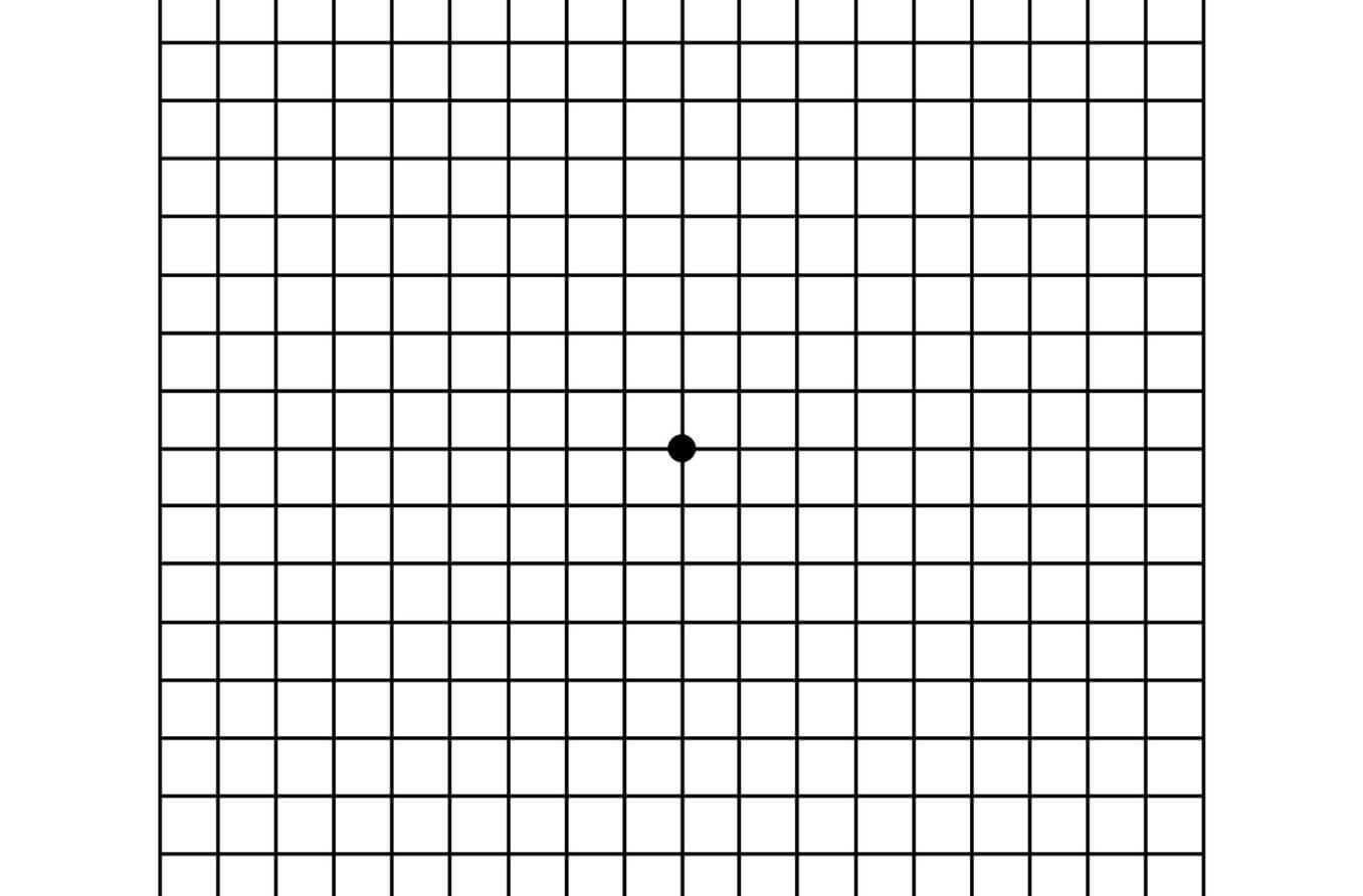 Amsler Grid Chart to Test for Macular Degeneration