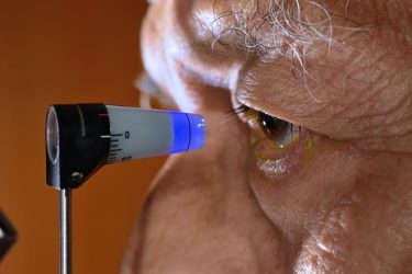 Primer plano de un hombre al que se le realizará un sondeo ocular