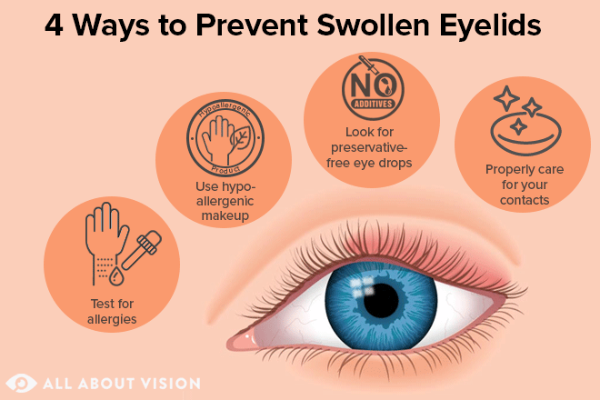 swollen eyelid