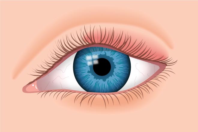 Swollen Eyelids: Causes And Treatment