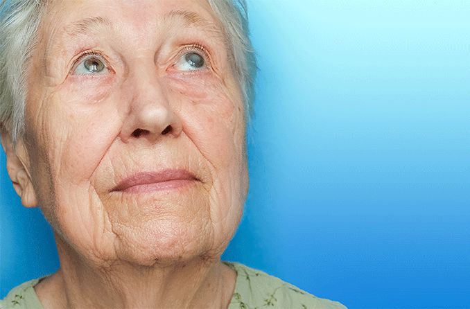 older woman with cataracts wondering if cataract surgery is safe