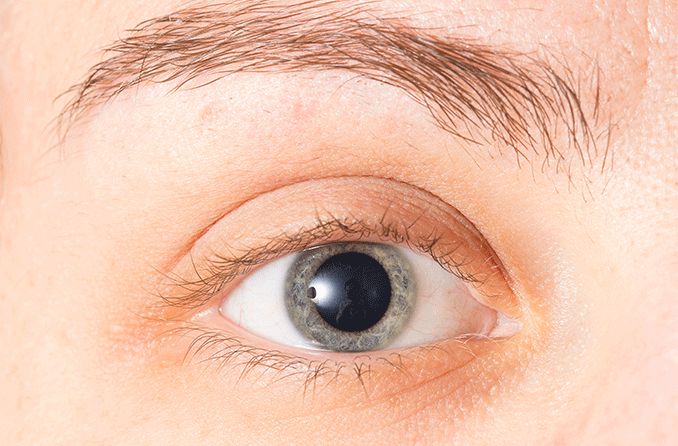 closeup of an eye with mydriasis