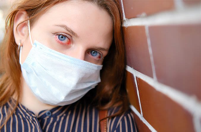 Frau mit chirurgischer Maske, die rote Augen vom Coronavirus hat