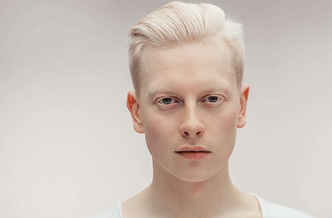 Albinism & Makeup: The Challenges of Choosing a Foundation