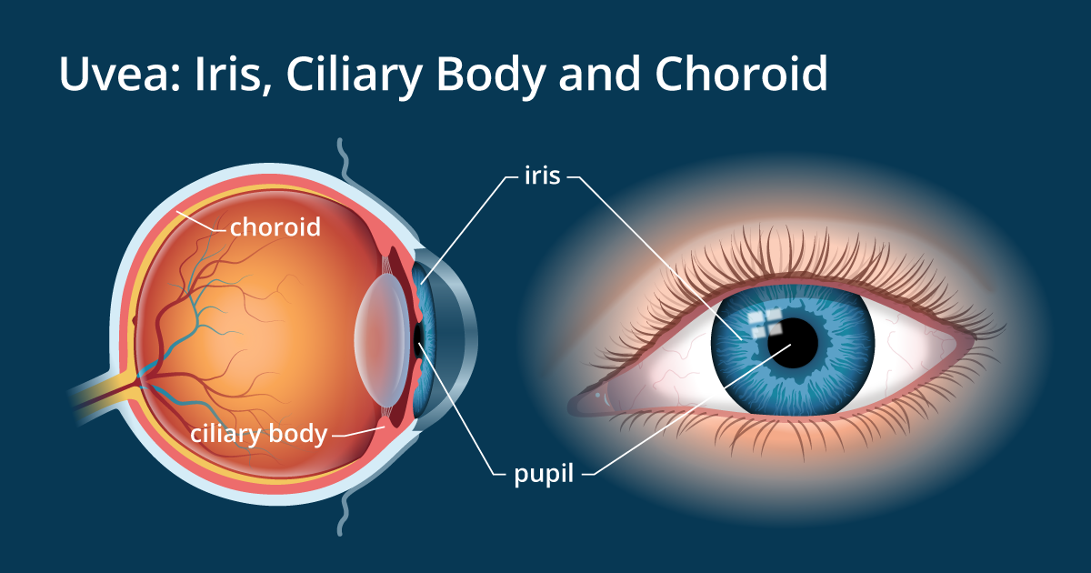 Iris And Uvea Of The Eye AllAboutVision Com   Uvea 1200x630 