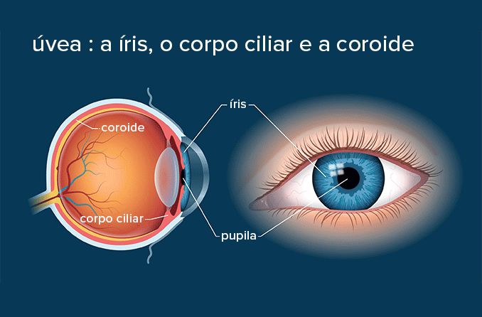 Ilustração da anatomia uvea, incluindo a íris, o corpo ciliar e o coróide.