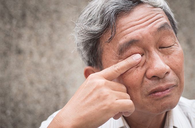 man rubbing infected eye with eye worms