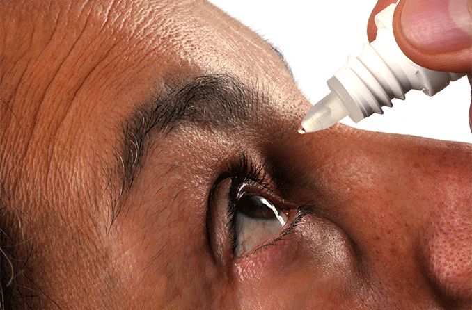 person putting ophthalmic solution into eye