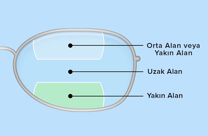 bifokal ve trifokal lenslerin illüstrasyonu
