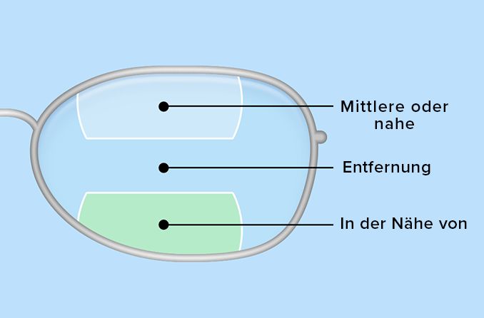 Abbildung von Bifokal- und Trifokallinsen
