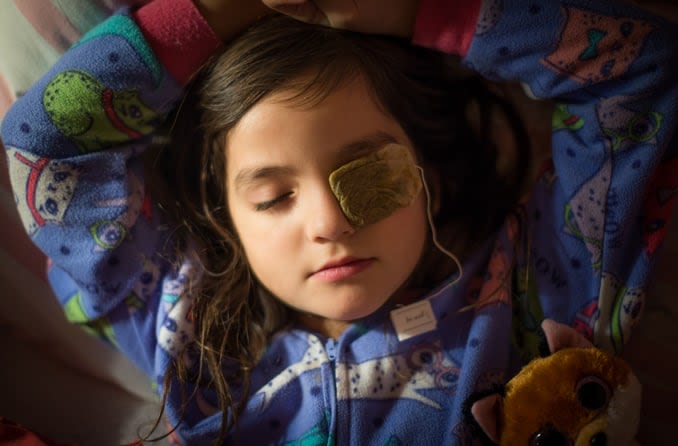 A young brunette girl in pajamas lies back with a warm tea bag over her eye stye.