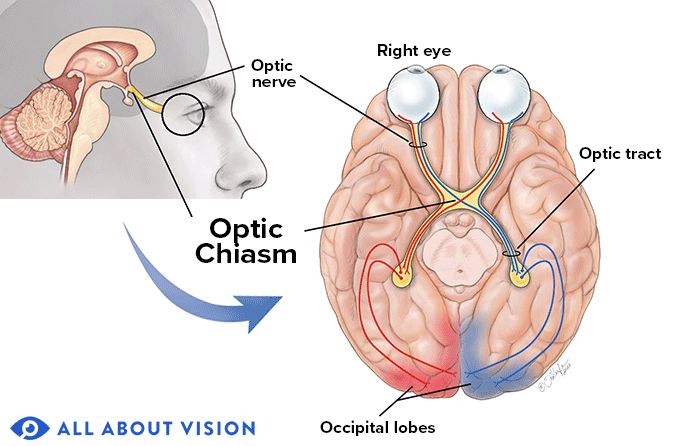 medical illustration of the optic chiasm in the brain