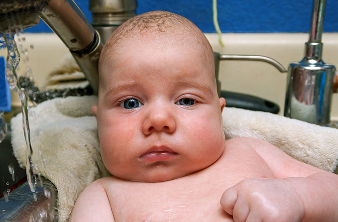 Newborn on sale swollen eyelid