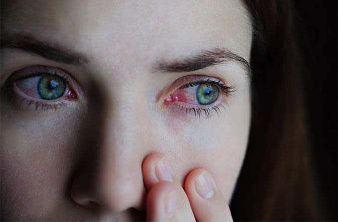 kırmızı gözlü ve koronavirüslü kadın