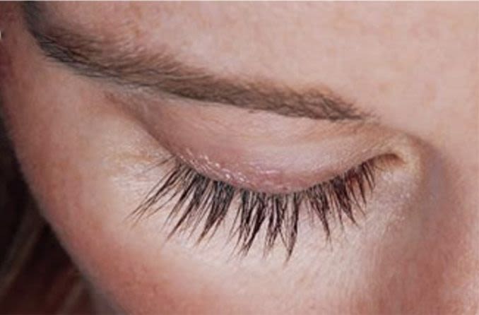 closeup of eyelashes after using Latisse