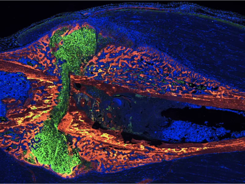 Imaging of a fracture callus