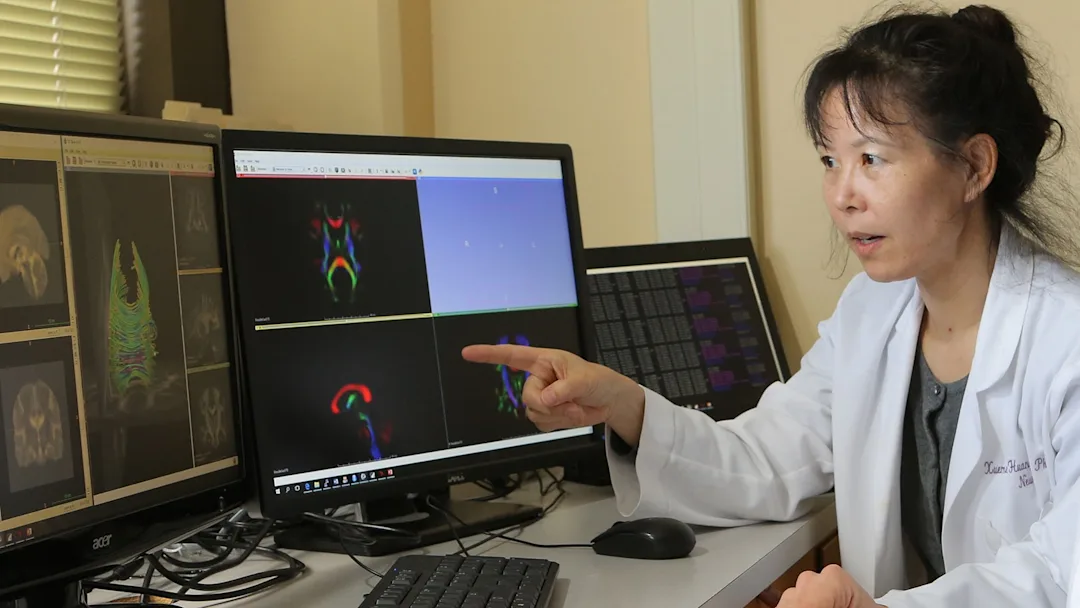 A woman in a lab coat points at brain scan images on dual computer monitors.