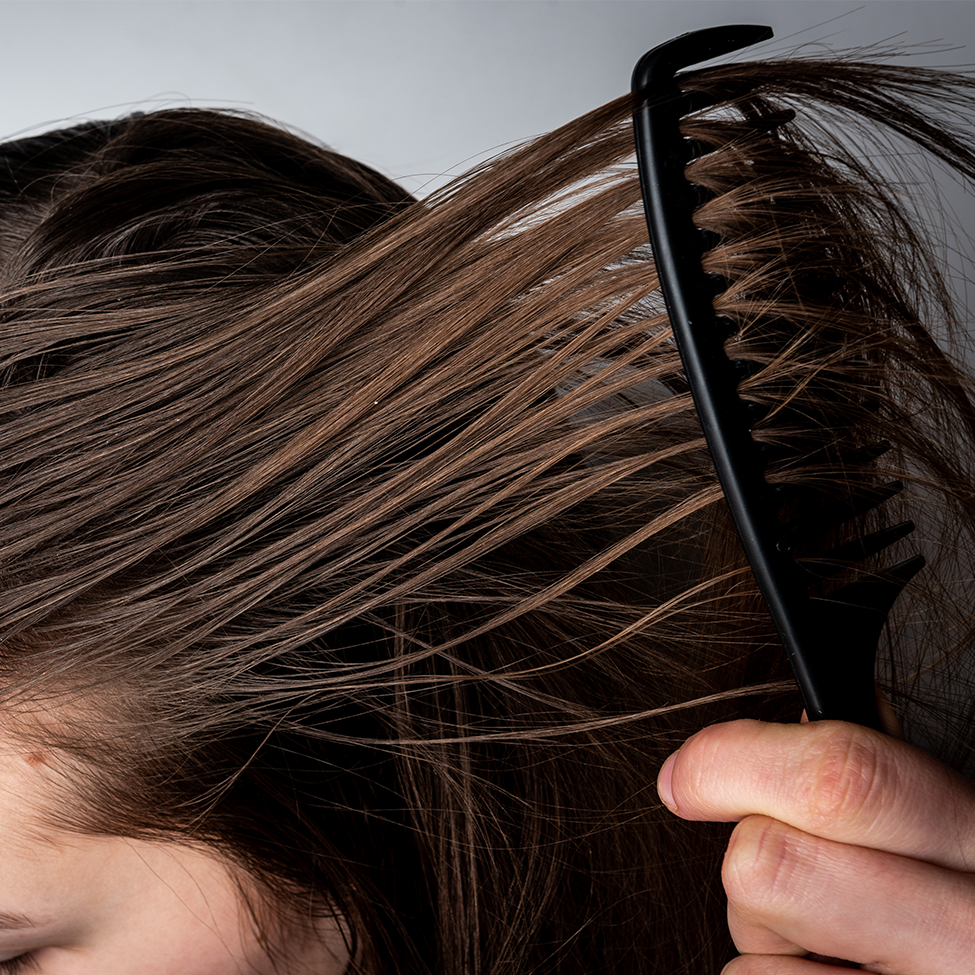 Itchy scalp and hair loss Link causes and treatment