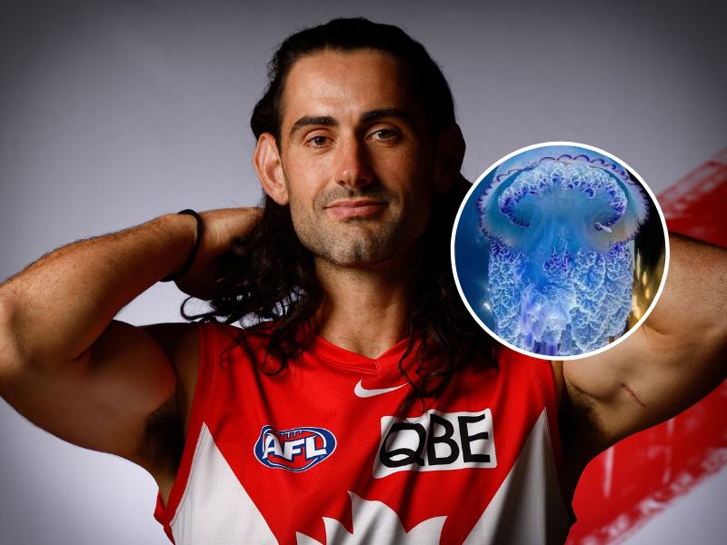 PICTURES Brodie Grundy suffers frightful injury on the day of