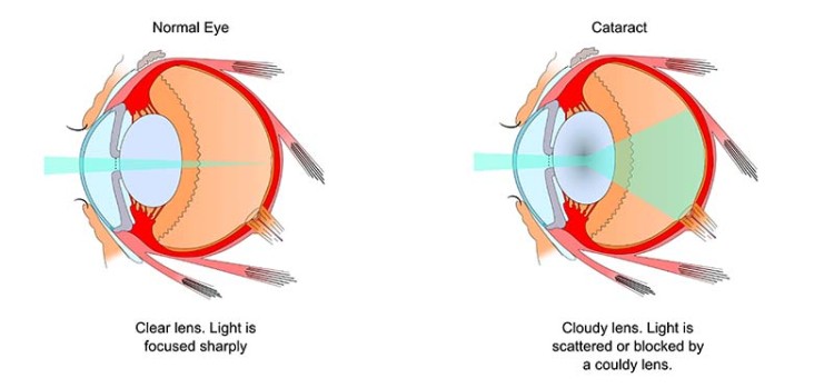 how much does dog eye surgery cost