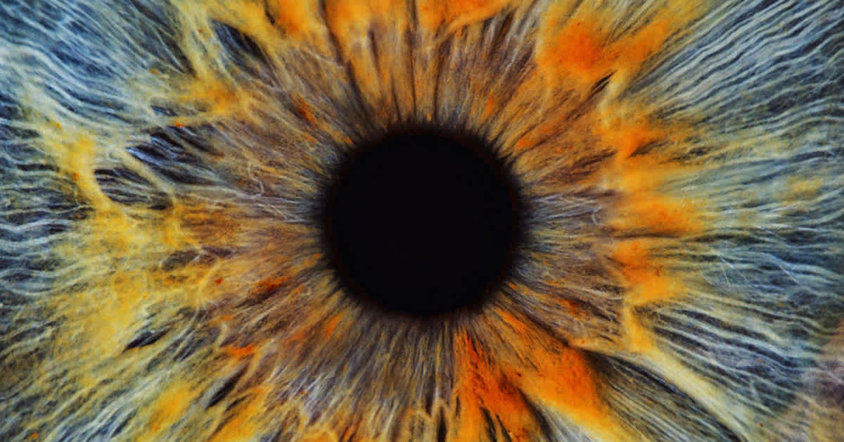 What is Observability image with title