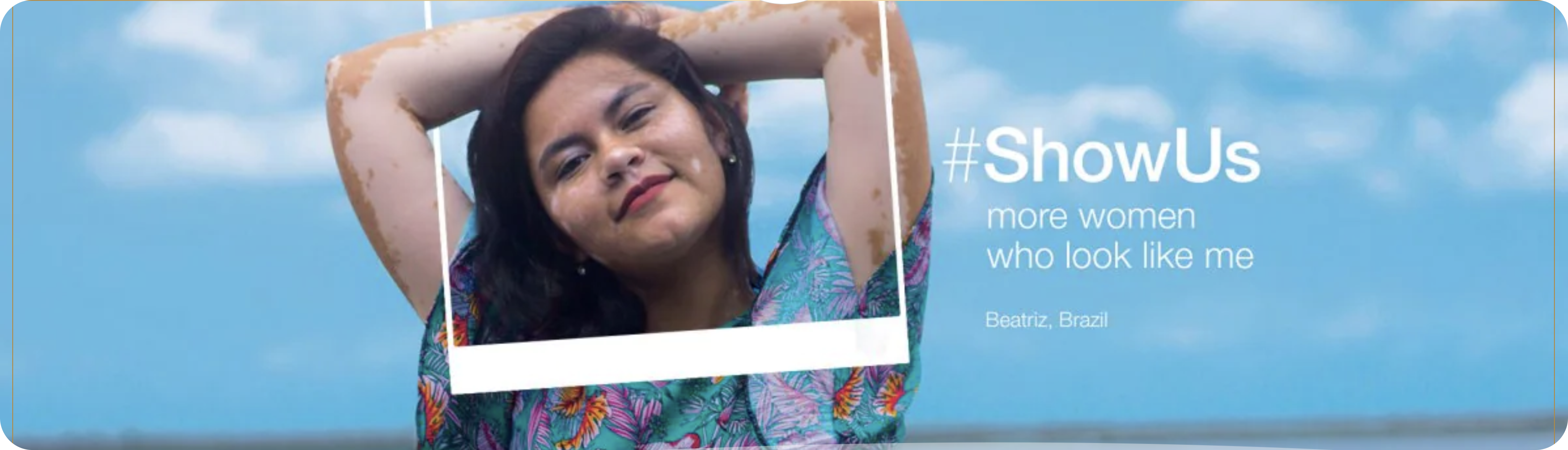 A headshot of a woman with vitiligo with a photo frame partly superimposed on her. The on-image text of this pic from Dove's #ShowUs campaign says, "#ShowUs more women who look like me."