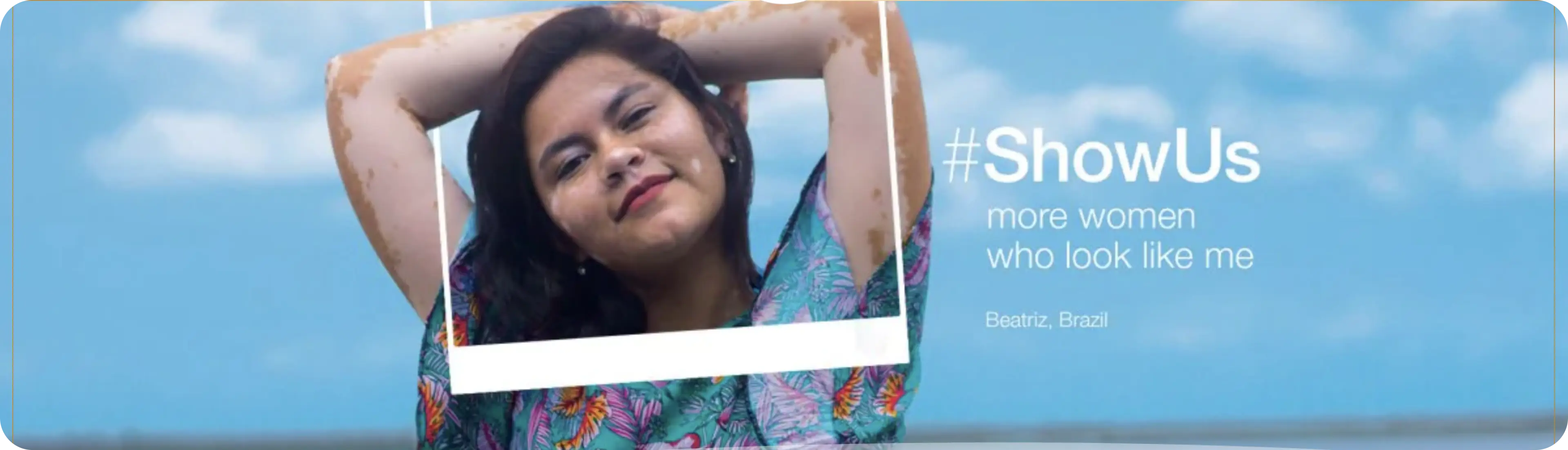 A headshot of a woman with vitiligo with a photo frame partly superimposed on her. The on-image text of this pic from Dove's #ShowUs campaign says, "#ShowUs more women who look like me."