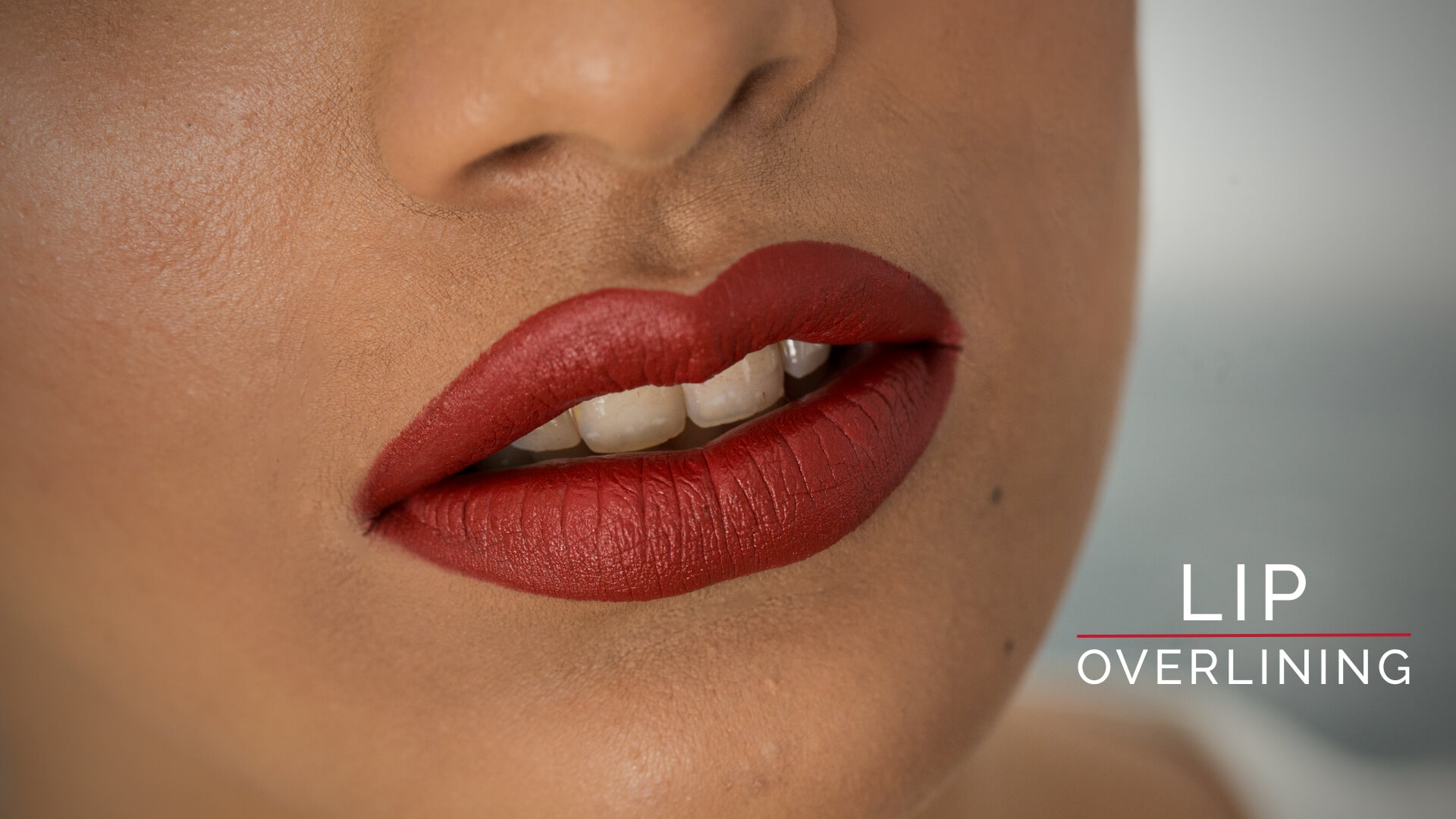 Lip Overlining